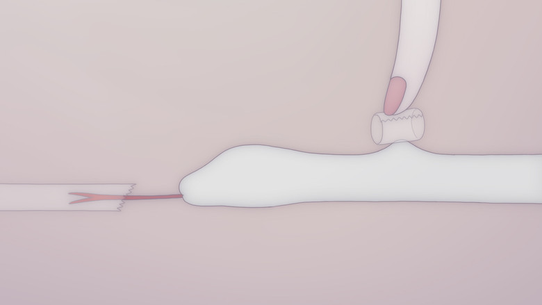 Anxious Body still 1