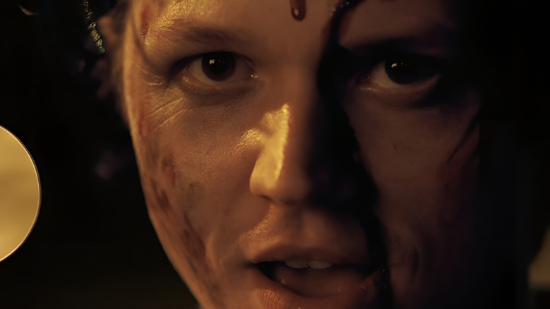 Wounds still 1