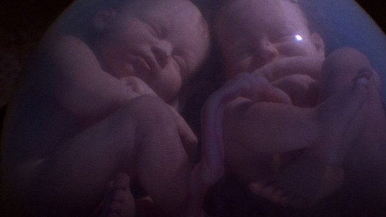 In the Womb: Multiples still 2